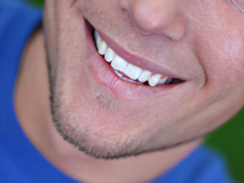 Esthétique du sourire Nimes